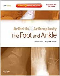 Arthritis & arthroplasty the foot and ankle